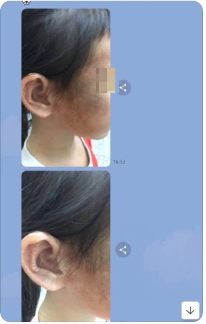 网友在网路社群Threads一则发文指，苗栗县一名国小一年级女童遭继母施虐、社工失能未处理。（翻摄Threads）