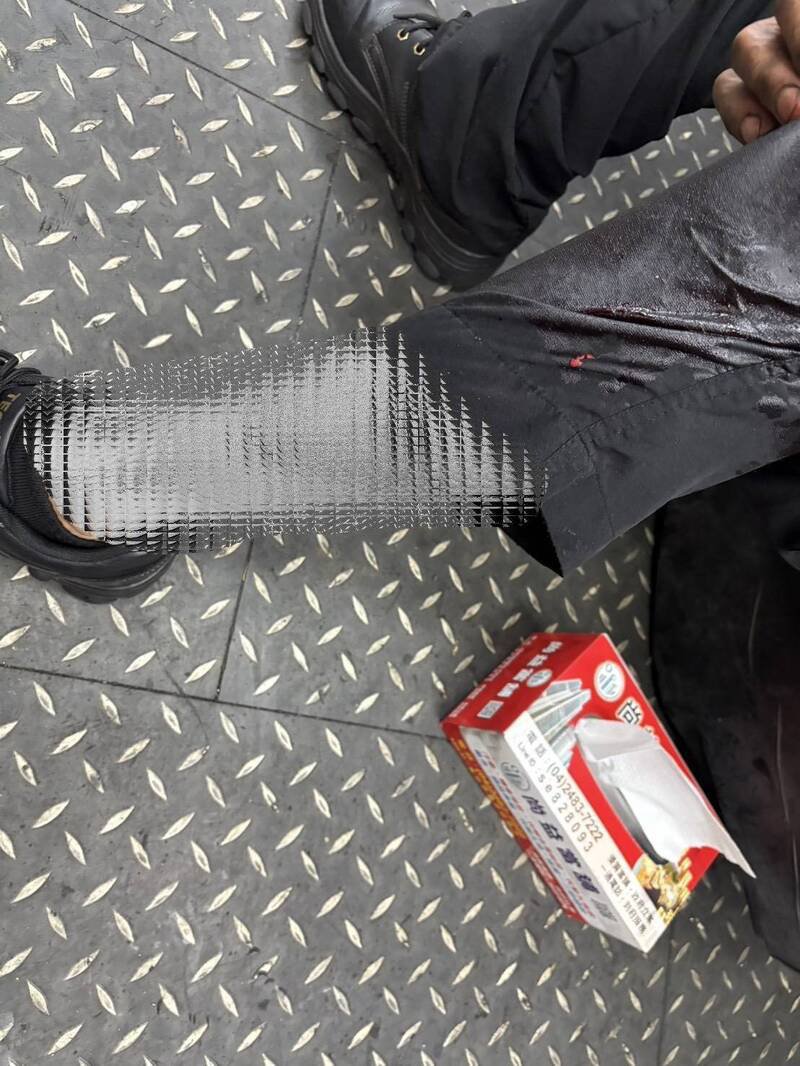 江男左小腿被砍伤。（民众提供）