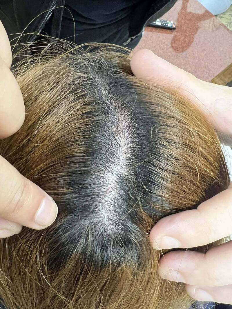 新北市永和区1间私立高职一年级女学生遭高三男学生以剪刀剪下头发，再从3楼拖行至1楼。（翻摄「许明伟」脸书）