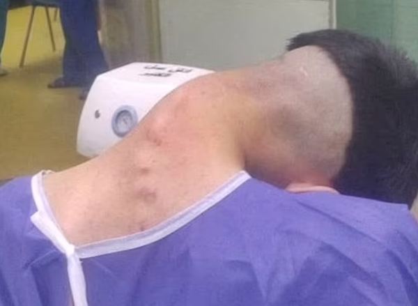 ▲▼             。（圖／翻攝自Iran’s Isfahan Medical University）