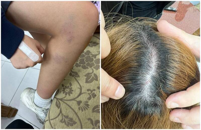 新北某高职一名高一女学生在校内与互不相识的高三学长碰撞，没想到学长当众对她叫嚣、拿美工刀割她头发，还将她从3楼硬扯到1楼，造成被害人身上多处瘀青。（图翻摄自脸书「我是新庄人许明伟」）